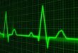 pulse trace, healthcare medicine, heartbeat, heart shape, medical equipment, equipment, symbol, graph, medical technical equipment, pulsating, medical supplies, wave pattern, computer graphic, monitoring equipment, heart beating, nobody, green computer, green heart, green laptop, green medical, green medicine, green pattern, green wave, green healthcare, green waves, green technical, heartbeat, heartbeat, heartbeat, heartbeat, graph, graph, graph, graph, graph