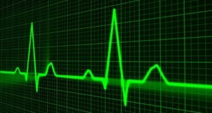 pulse trace, healthcare medicine, heartbeat, heart shape, medical equipment, equipment, symbol, graph, medical technical equipment, pulsating, medical supplies, wave pattern, computer graphic, monitoring equipment, heart beating, nobody, green computer, green heart, green laptop, green medical, green medicine, green pattern, green wave, green healthcare, green waves, green technical, heartbeat, heartbeat, heartbeat, heartbeat, graph, graph, graph, graph, graph