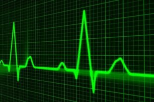 pulse trace, healthcare medicine, heartbeat, heart shape, medical equipment, equipment, symbol, graph, medical technical equipment, pulsating, medical supplies, wave pattern, computer graphic, monitoring equipment, heart beating, nobody, green computer, green heart, green laptop, green medical, green medicine, green pattern, green wave, green healthcare, green waves, green technical, heartbeat, heartbeat, heartbeat, heartbeat, graph, graph, graph, graph, graph