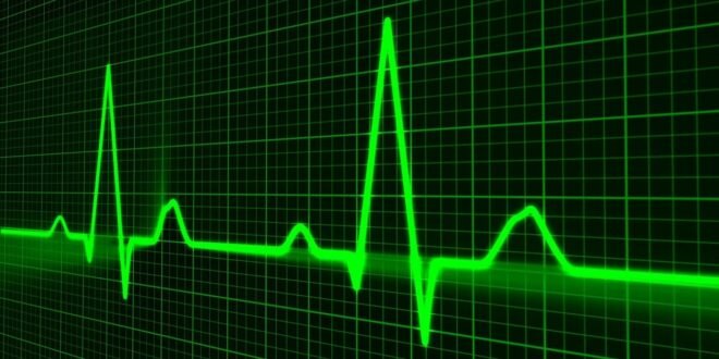 pulse trace, healthcare medicine, heartbeat, heart shape, medical equipment, equipment, symbol, graph, medical technical equipment, pulsating, medical supplies, wave pattern, computer graphic, monitoring equipment, heart beating, nobody, green computer, green heart, green laptop, green medical, green medicine, green pattern, green wave, green healthcare, green waves, green technical, heartbeat, heartbeat, heartbeat, heartbeat, graph, graph, graph, graph, graph